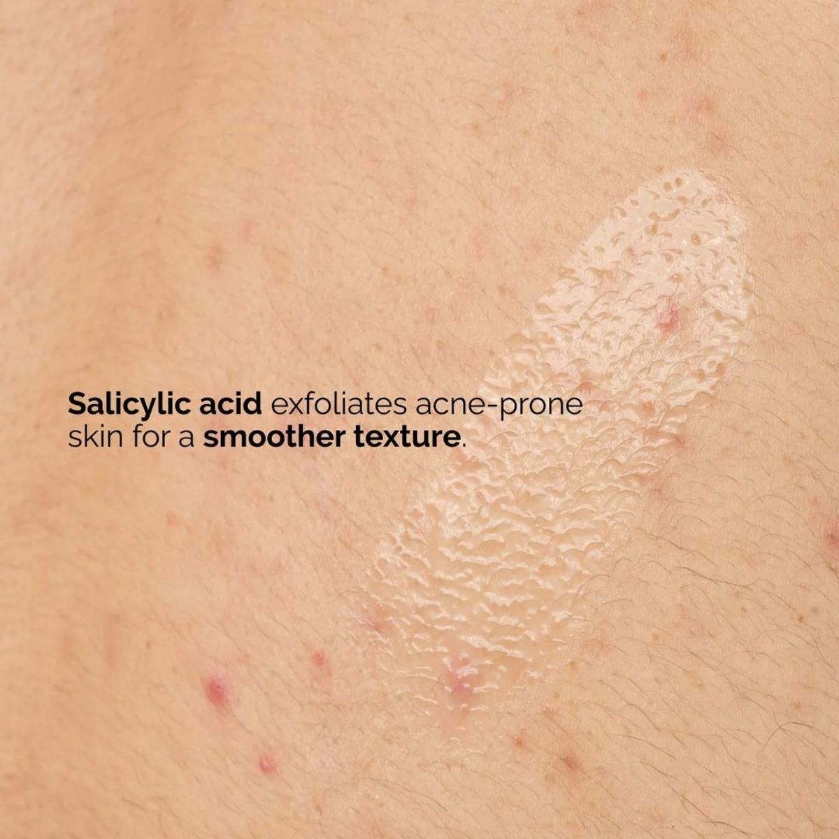 FG - The Ordinary Body Care Salicylic Acid Body Serum